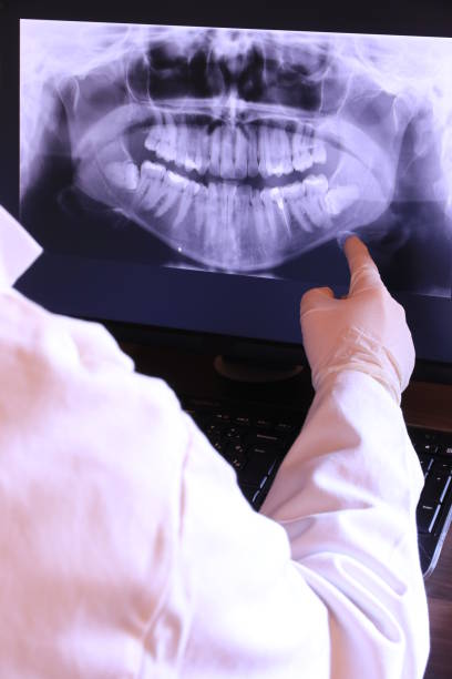Best Emergency Tooth Extraction  in Golden Glades, FL