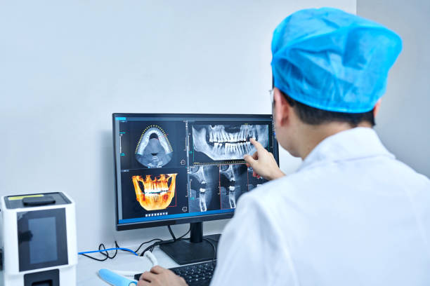 Emergency Dental Filling Replacement in FL